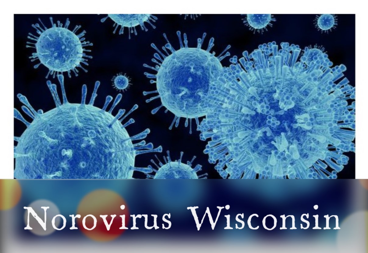  What’s the difference between Norovirus Wisconsin and stomach bug?